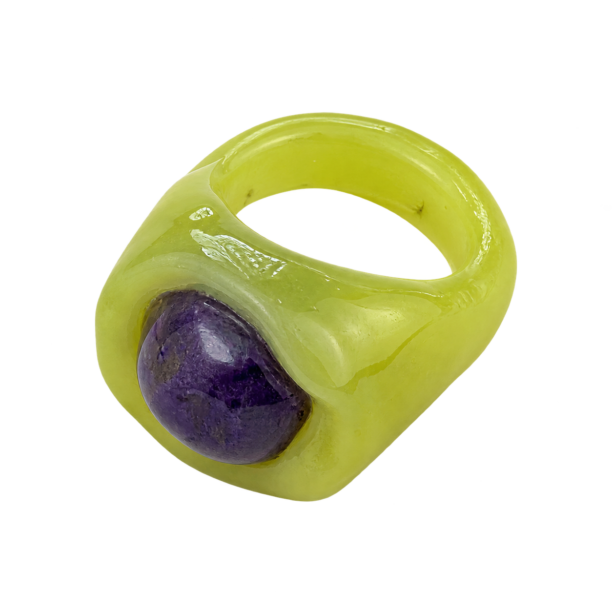 Ring 35, Ansicht 1