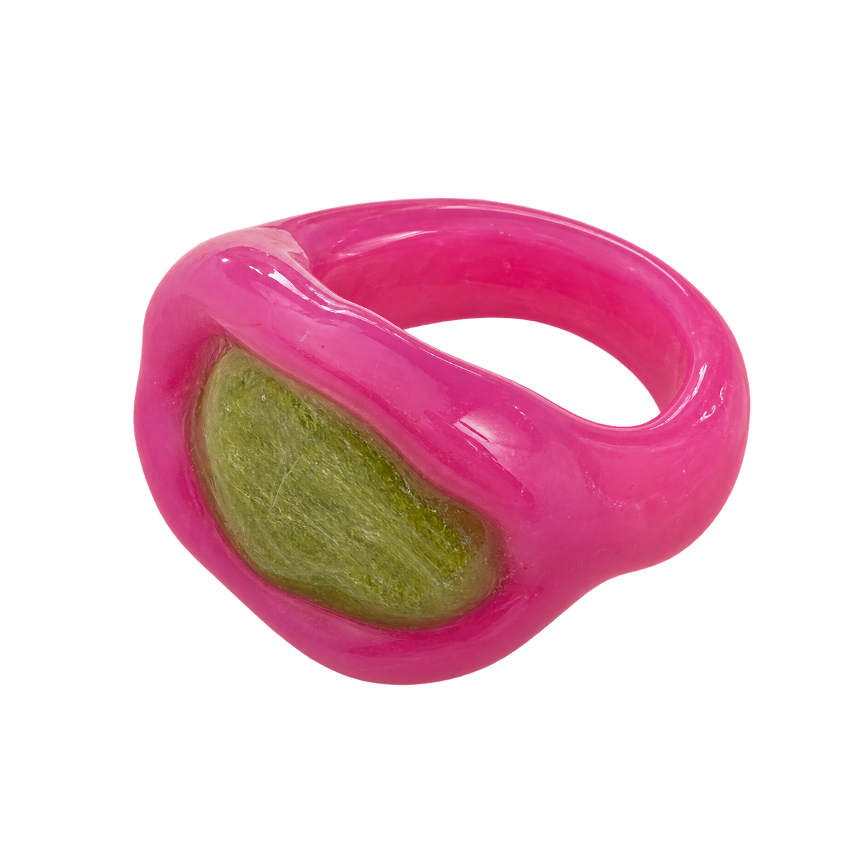 Ring 26, Ansicht 1